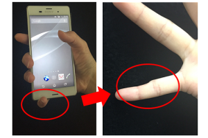 Smartphone Pinky ติดสมาร์ทโฟนมากเกินไป ระวัง! นิ้วผิดรูป