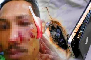 อุทาหรณ์!! หนุ่มมาเลเซียวัย 28 ปีเจ็บหนัก มือถือระเบิดใส่หน้า หลังกดรับสายขณะชาร์จแบตเตอรี่