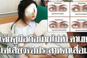 หมอชี้แจง! อย่าแตกตื่นเหตุเล่นสมาร์ทโฟนมากทำเด็กตาเข ควรห่วงจอประสาทตาเสื่อมมากกว่า!